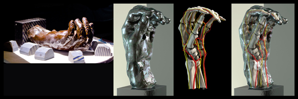 Inside Rodin’s Hands: Art, Technology, and Surgery